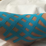 kinesiotaping