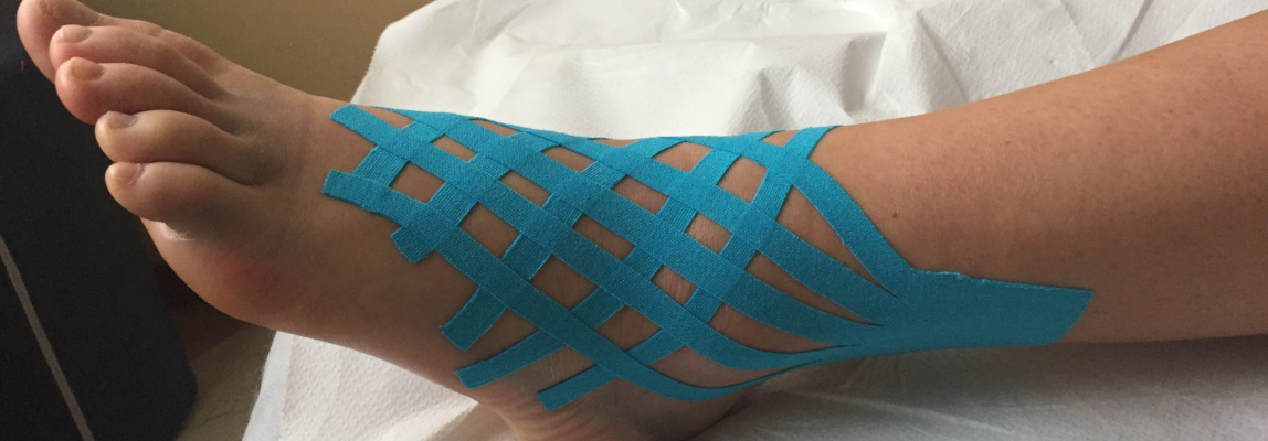 kinesiotaping